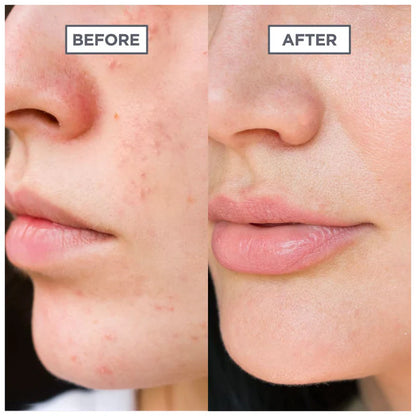 Glow Serum Niacinamide